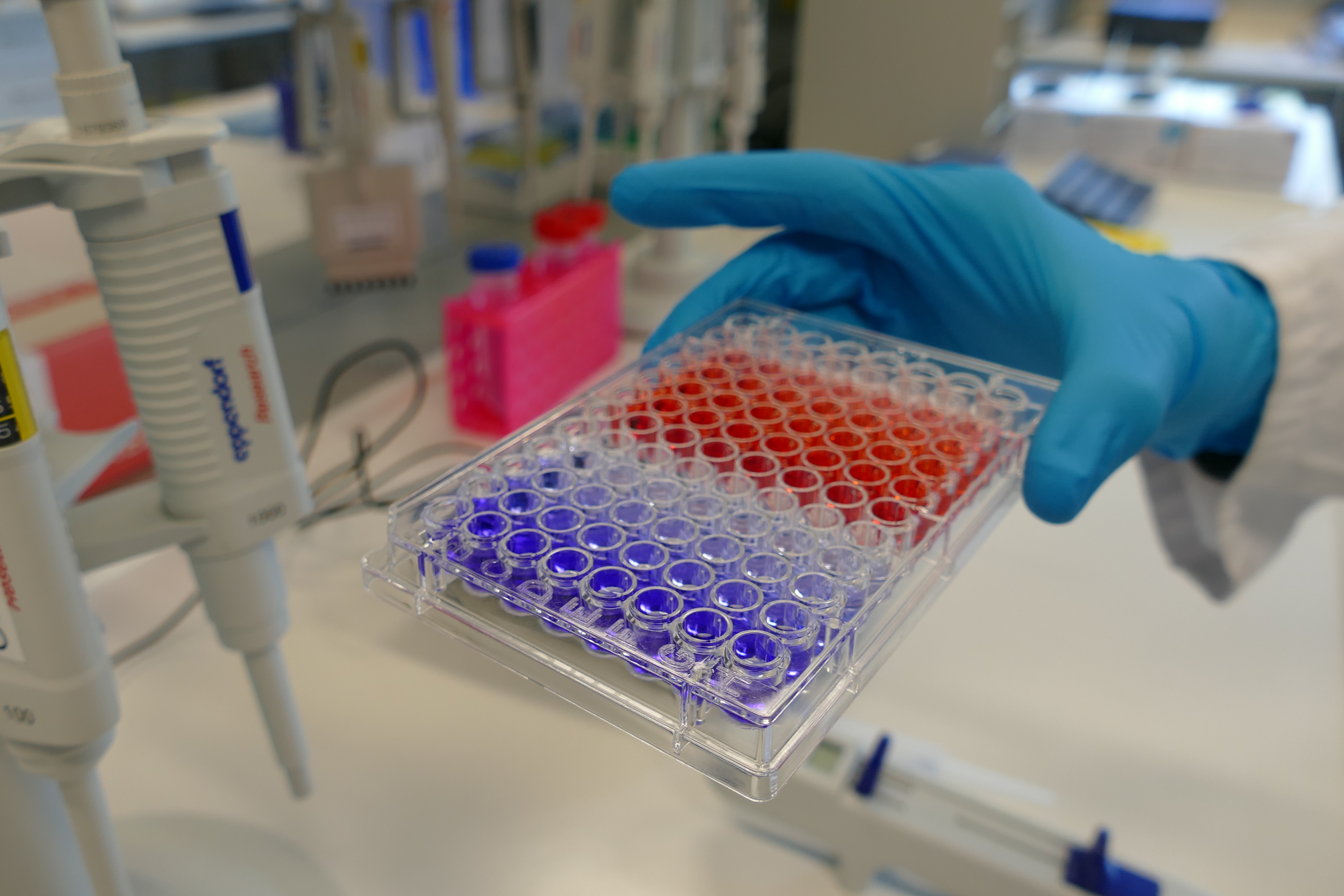 Eine Hand in einem blauen Latexhandschuh hält eine Platte mit Vertiefungen, die zur hälfte mit roten und blauen Flüssigkeitsproben gefüllt sind. Die jeweiligen Farben variieren von stark blau bzw. rot zu einem blasseren Farbton.