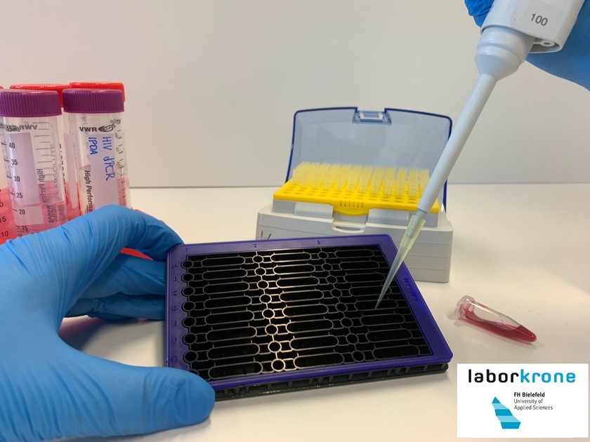 Beladung eines Probenträgers mit Patientenproben für die digitale PCR. Es können gleichzeitig 96 Proben gemessen werden, die Probenflüssigkeit wird auf 6500 Nanoporen verteilt.